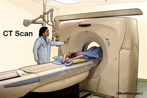 the villages cat scan procedure|CT Scan (CAT Scan): Purpose, Procedure, Risks, .